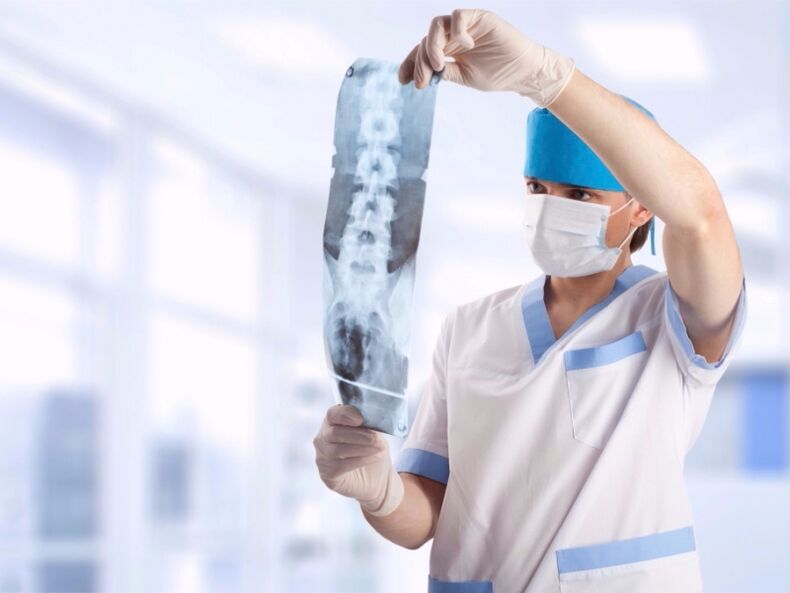 lekarz patrzy na migawkę odcinka szyjnego kręgosłupa z osteochondrozą