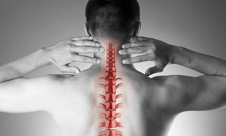 Jak objawia się osteochondroza kręgosłupa szyjnego
